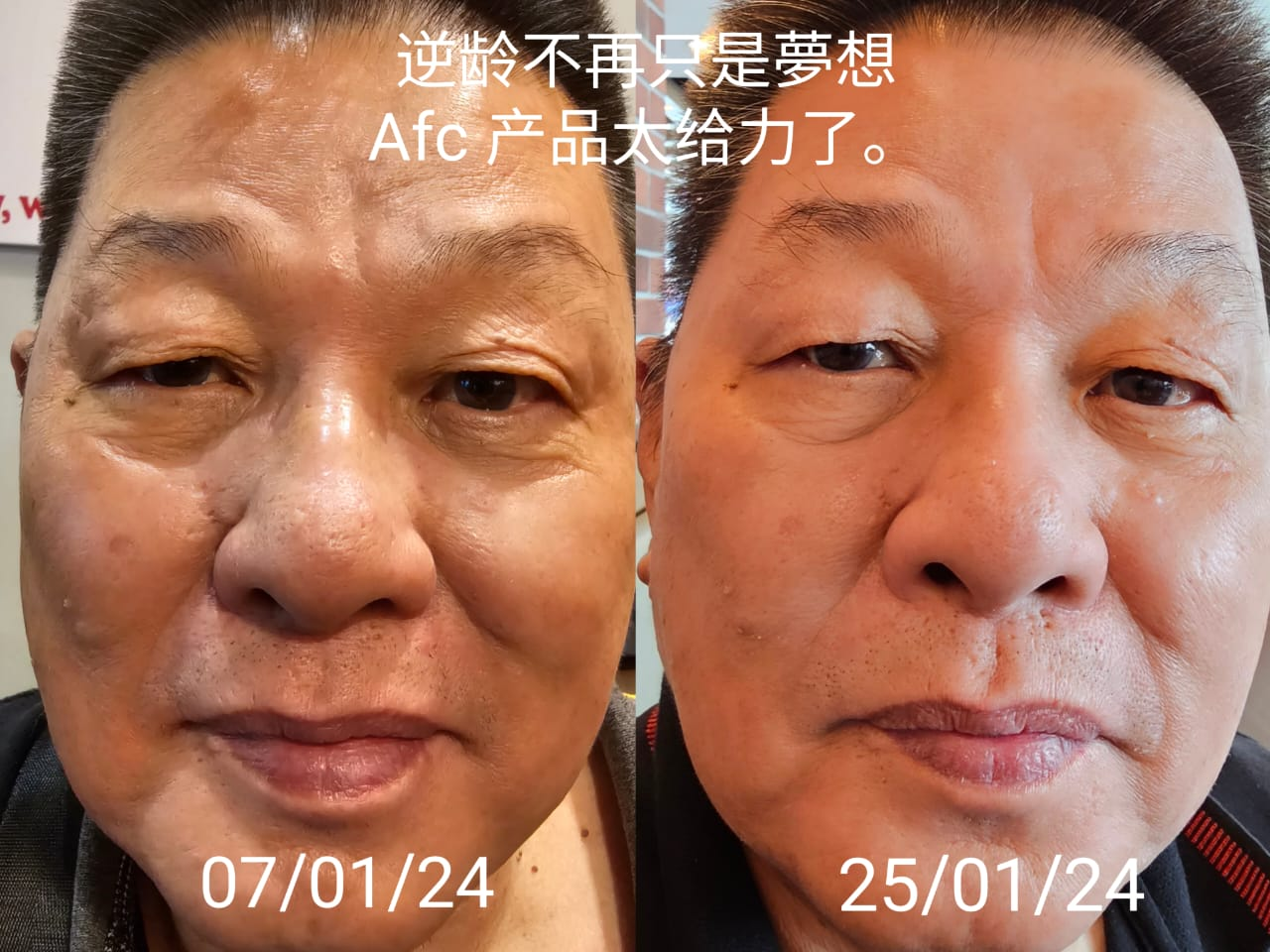 afc-story-img-1
