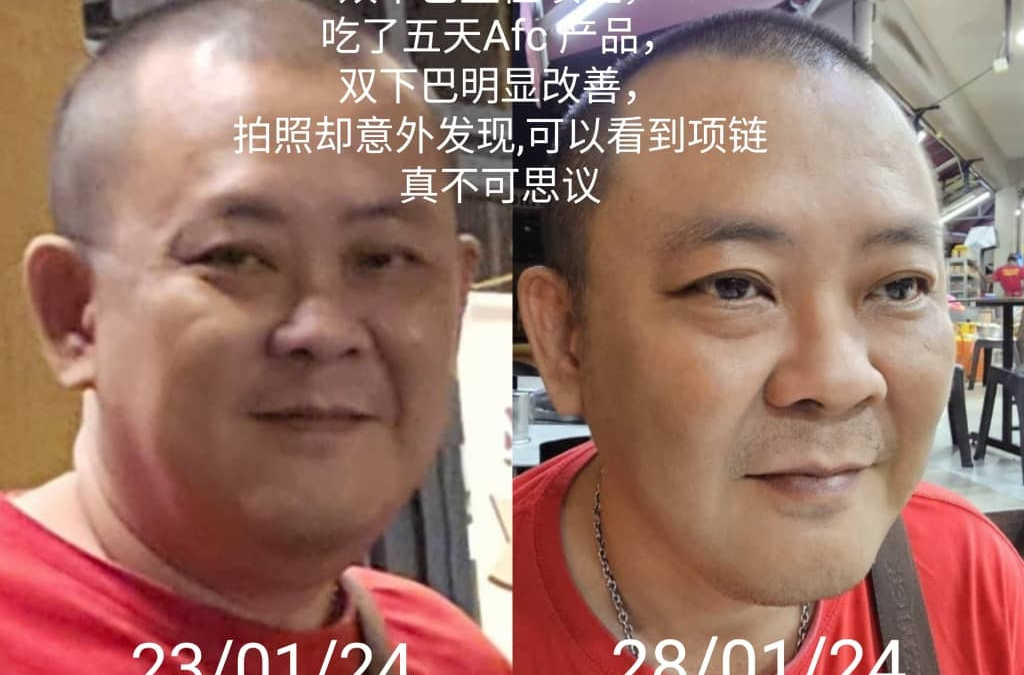 After taking AFC for 5 days, my double chin has noticeably improved.