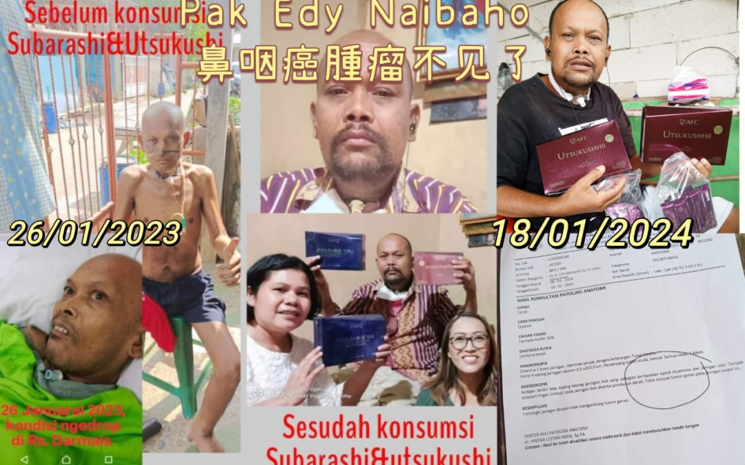 Kanser nasofaring telah sembuh, AFC memberinya peluang kedua untuk hidup.